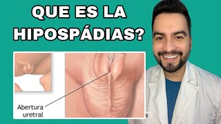 Que Es La Hipospádia? Dr David Campos