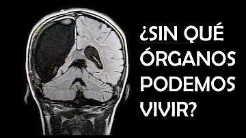 ¿Sin qué órganos no se puede vivir?