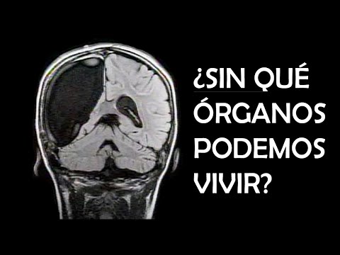 Video: ¿Podrías vivir sin vejiga?