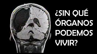 ¿SIN QUÉ ÓRGANOS PODEMOS VIVIR?