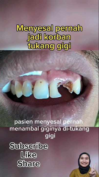 TAMBAL GIGI DEPAN YANG TINGGAL SEDIKIT
