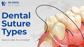 Dental Suture Types - which one to choose?