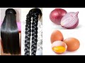 How to grow hair faster naturally in a week with egg at home | Hair growth with onion