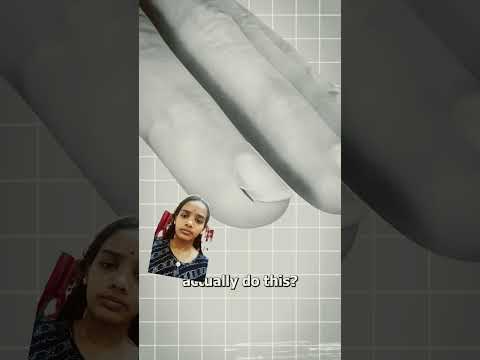 Why You Shouldn't Peel Your Hangnails Ll Subscribe For More Videos Youtube Youtubeshorts