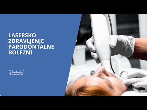 Video: Akutni Iridociklitis - Zdravljenje, Simptomi, Vzroki