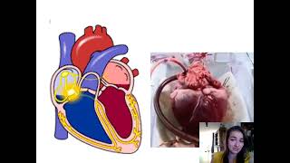 Samenvatting Bloedsomloop 2MHV Biologie Voor Jou MAX