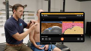 T-Mode™ Shoulder for Physical Therapy Education Update