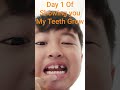 Day 1 (when I said Something with my tongue while opening my mouth I actually said "As it Grows")