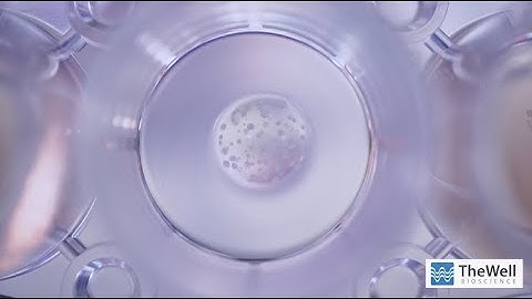 Harvest Organoids from ECM - Quick, efficient 10 min protocol. High recovery of intact organoids.