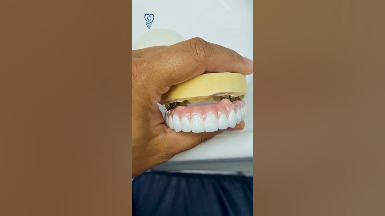 Самые белые зубы в мире. Имплантация зубов. The whitest teeth in the ...