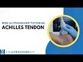 Achilles Tendon On Musculoskeletal Ultrasound 