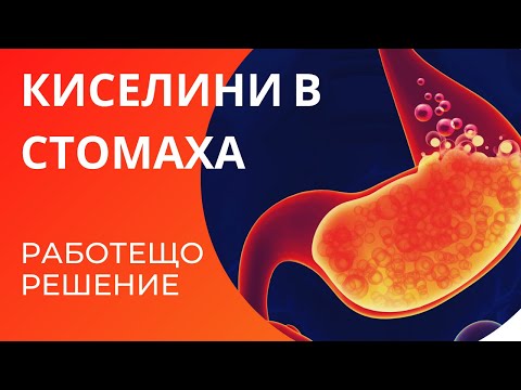 Киселини в стомаха(РЕФЛУКС) - РАБОТЕЩО РЕШЕНИЕ