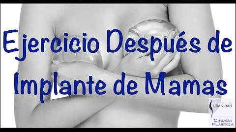 ¿Qué ejercicios no se pueden hacer con implantes mamarios para siempre?