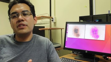 AS014 - Dermoscopic image Processing for Cancer Detection