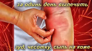 Чесотка, зуд, сыпь на коже, красные пятна можно вылечить за один день