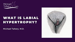 What is Labial Hypertrophy? | Dr. Michael Tahery