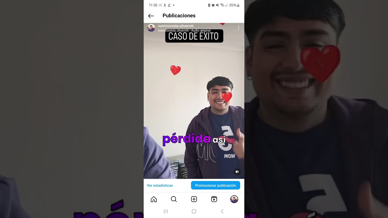 Imagen 11 de servicio