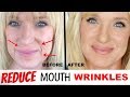 Get RID Of MOUTH WRINKLES! WithOUT Fillers!