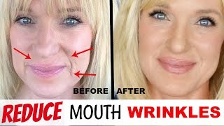 Get RID Of MOUTH WRINKLES! WithOUT Fillers!