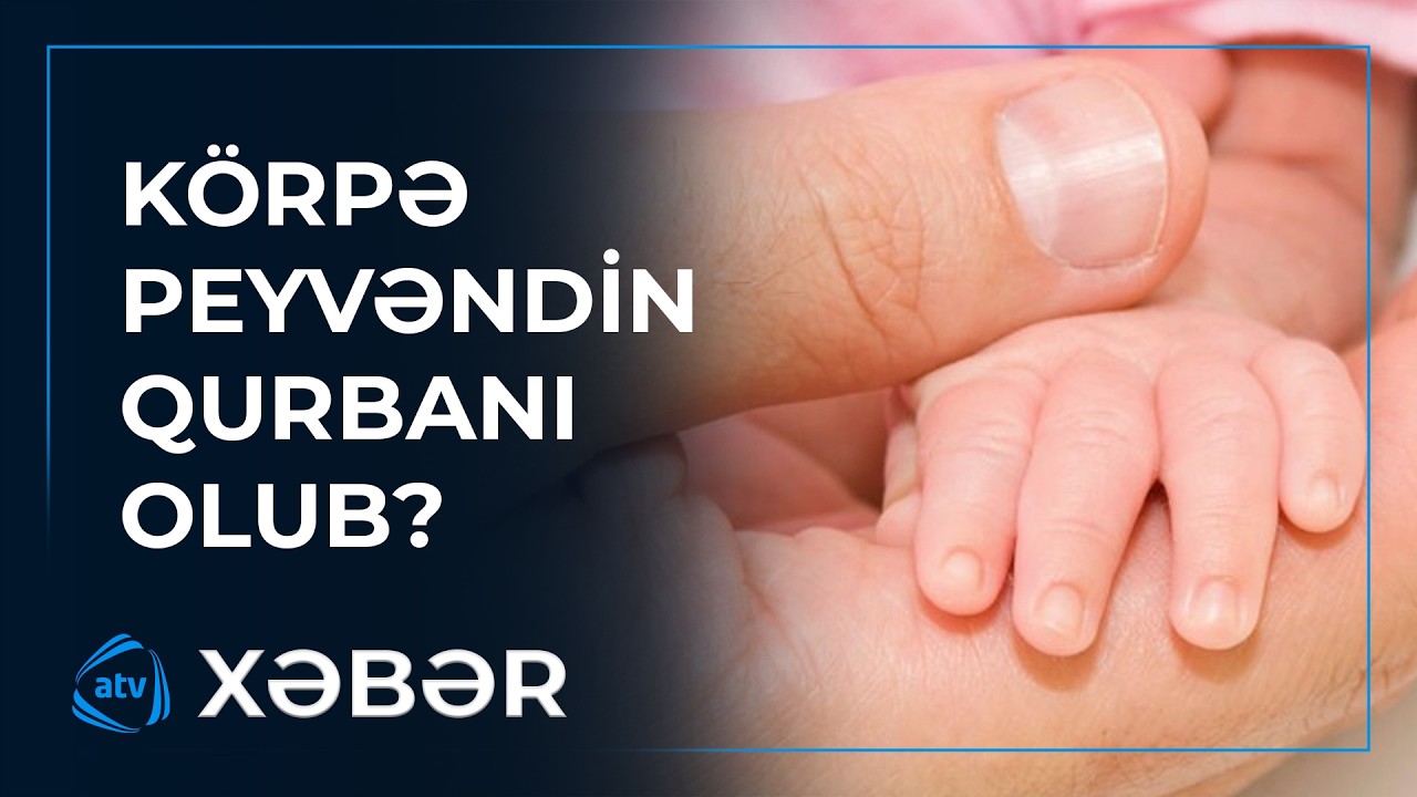 Azyaşlı körpə peyvəndin qurbanı olub?