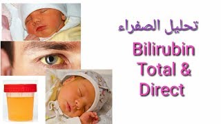 تحليل الصفراء Bilirubin Total &Direct0 تعليم التحاليل الطبية للمبتدئين