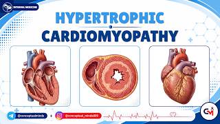 11. Hypertrophic Cardiomyopathy 🫀 | Murmurs, Genetics & Sudden Death Risk