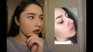 Eyelash Extensions Review | PROS & CONS