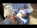 Kids Dentist Visit | 2 Crown teeth