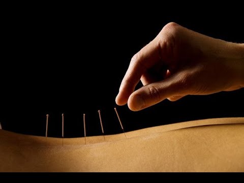 Acupuncture videos