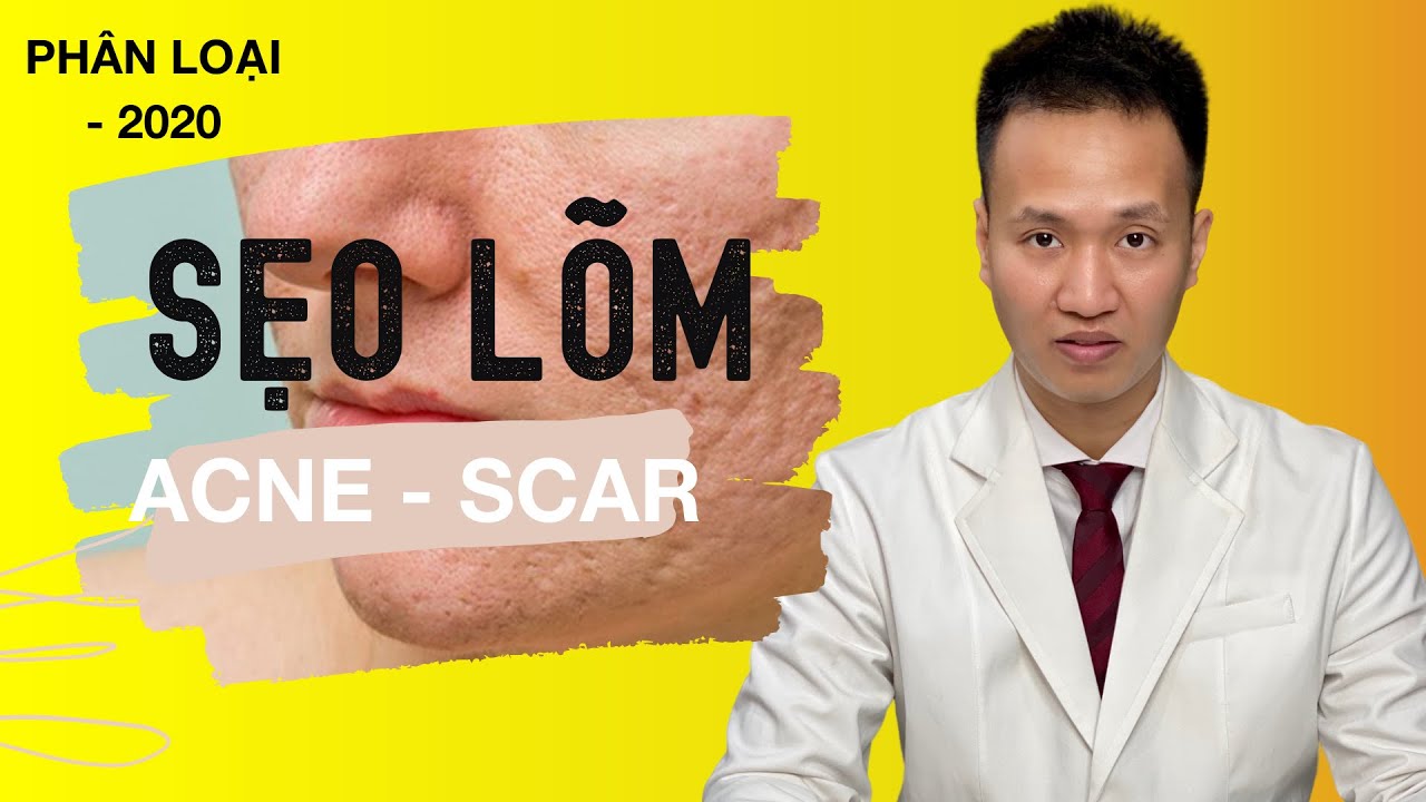 [2] SẸO RỖ có đến 6 loại ?10 Sai lầm TAI HẠI trong điều trị sẹo khiến SẸO không cải thiện- Dr Hiếu