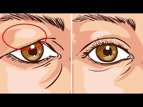 Video: Wie Man Ein Herabhängendes Augenlid Mit Make-up Korrigiert