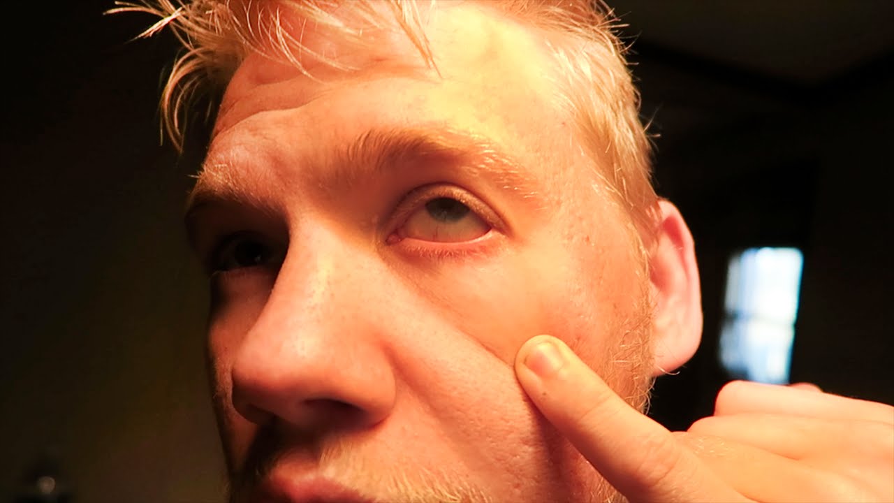 BUFFALO CHICKEN EYE BURN!!! YouTube