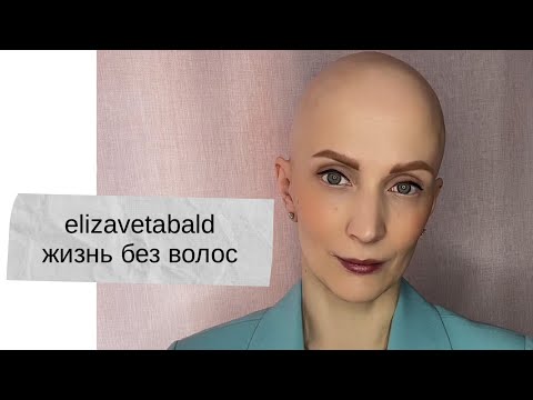ЖИЗНЬ БЕЗ ВОЛОС #алопеция