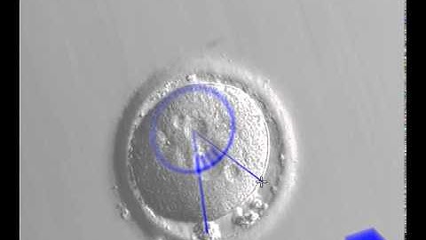 Demonstration Video for "Artificial Defocus for Displaying Markers in Microscopy Z-Stacks"