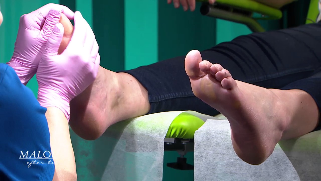 Så förebygger du fotproblem och fotskador - Malou Efter tio (TV4)