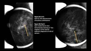 326 Hz : Calcifications (RIFE Healing Frequency)