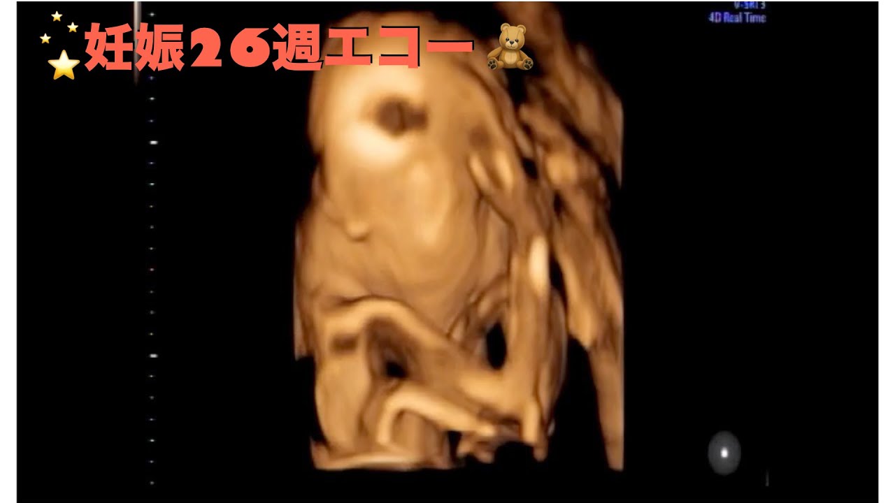 妊娠26週 胎児エコー Youtube