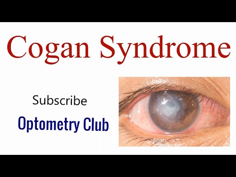 Cogan Syndrome Introduction, Clinical features, Diagnosis and Treatment