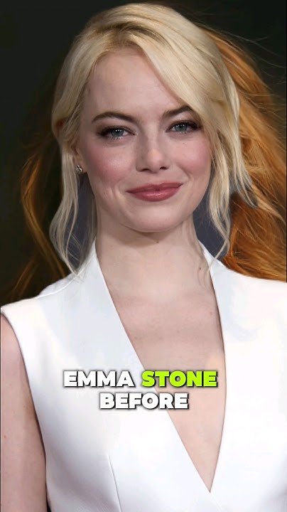 Emma Stone'S Shocking Secret: She'S Bald! (And Wearing A Wig) - 1ky683y