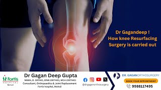 Dr Gagandeep | How knee Resurfacing Surgery is carried out screenshot 2