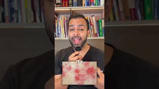 Shingles painful rash from reactivated chickenpox virus Early treatment is crucial