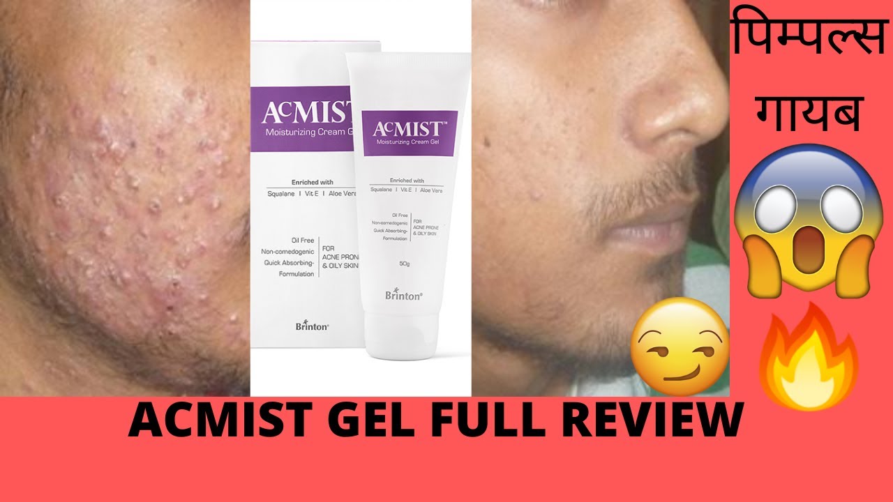 🌈 Acmist Moisturizing Cream Gel Review ByeBye Oily Skin Woes! 🔥