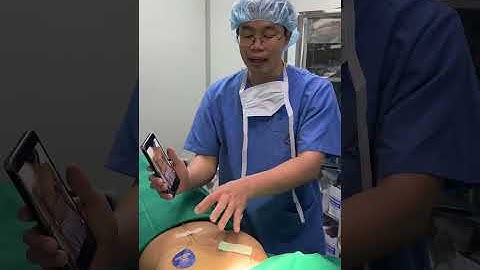 Nâng ngực cho khách hàng khuyết một bên ngực do ung thư tuyến vú