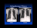 Review of Chest Image Interpretation