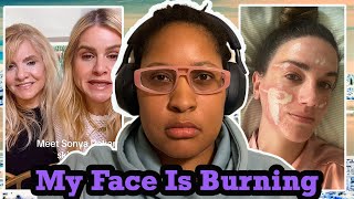 TikToker Exposes Celebrity Esthetician For Destroying Her Face