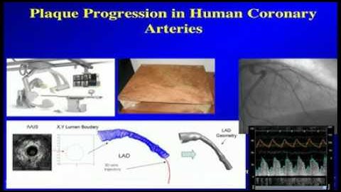 Biomechanics, Imaging, Vascular Biology and Translation to Patients