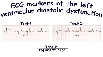 ECG markers of the left ventricular diastolic dysfunction: Tend-P, Tend-Q