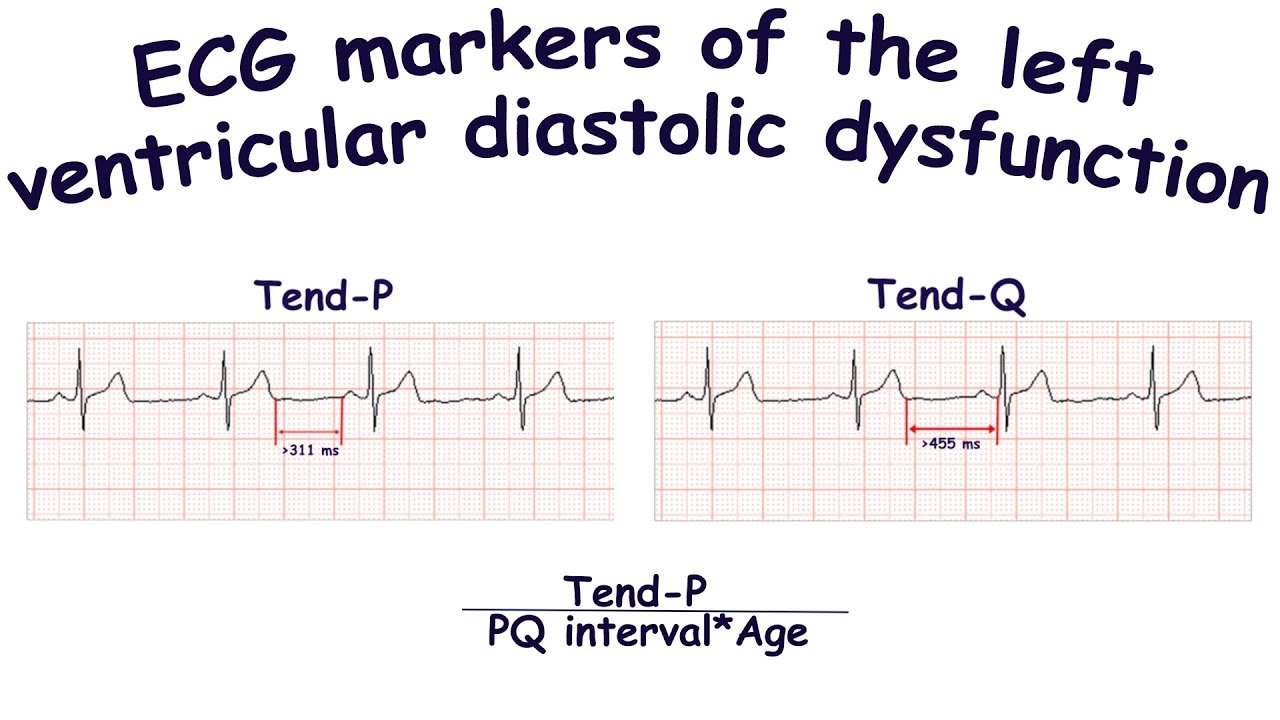 Common mistakes - Diastolic Dysfunction