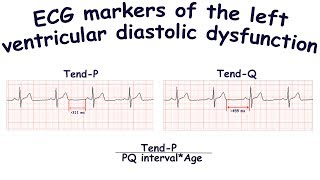 Common mistakes - Diastolic Dysfunction