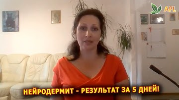 Отзывы APLGO ► Нейродермит - результат за 5 дней! Благодаря леденцам APL